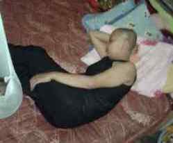 Iis Idawati Penderita Kanker Pembesaran Kepala Terkulai Lemas di Rumahnya